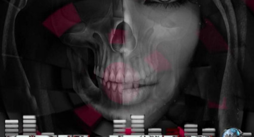 Kick'n Drum Militia Radio Set 31.03.27